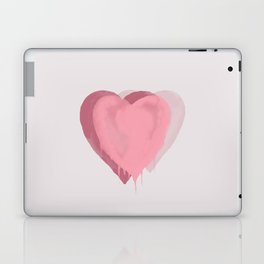 Heart Change 2. Laptop Skin