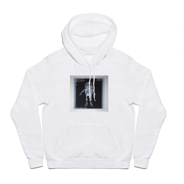 X-Ray of Famous Chillie Willie Hoody