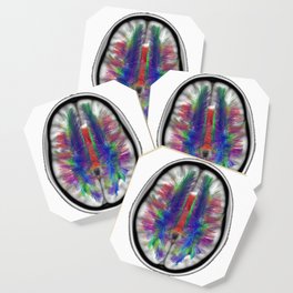 Axial Fibers Clear Coaster | Stem, Science, Brain, Neuroscience, Colorful, Dti, Whitematter, Graphicdesign, Axial 
