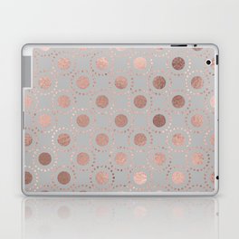 Rosegold simple pink metal foil polkadots on grey background 1  Laptop Skin