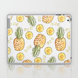 Pineapple by Kerry Beazley Laptop Skin