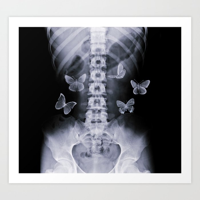 X-Ray Conceptual Butterflies  Art Print