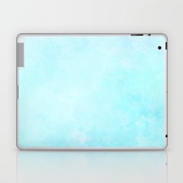Soft Framed Blue Sky Laptop Skin