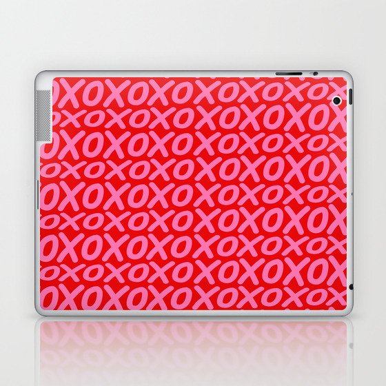 Pink Hugs and kisses Valentine gift Laptop & iPad Skin