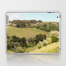 Old Winchester Hill Laptop Skin