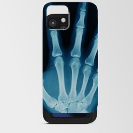 Hand X-Ray iPhone Card Case