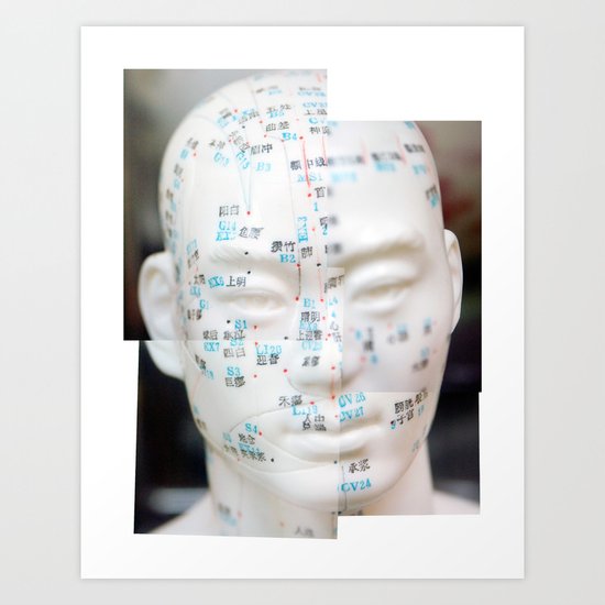 Acupuncture! Art Print