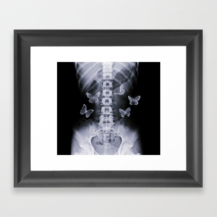 X-Ray Conceptual Butterflies  Framed Art Print