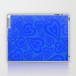 Retro Love Swirl - Bright True Blue Laptop Skin