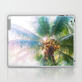 Mexican Palm Tree Vibes #1 #tropical #wall #art #society6 Laptop Skin