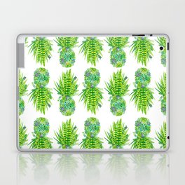 Pineapple Succulent Laptop Skin