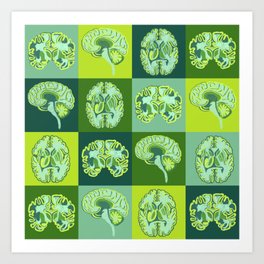 Brain Sections Art Print | Axial, Geek, Graphicdesign, Digital, Nerd, Chalk, Frontal, Brain, Sagittal, Coronal 