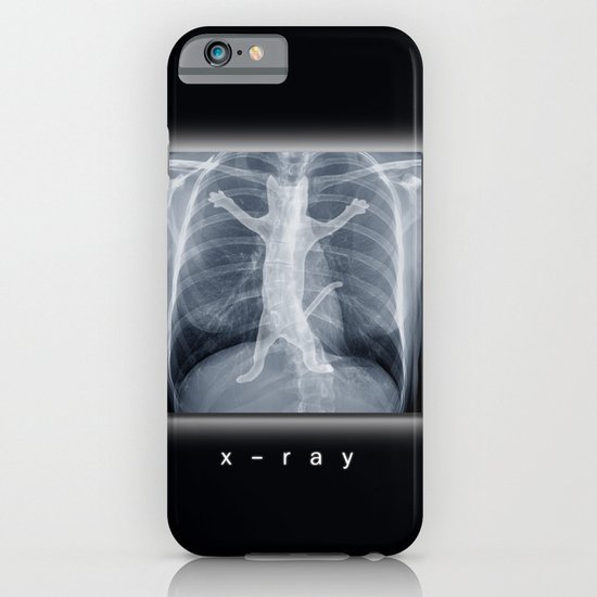 x-ray iPhone & iPod Case